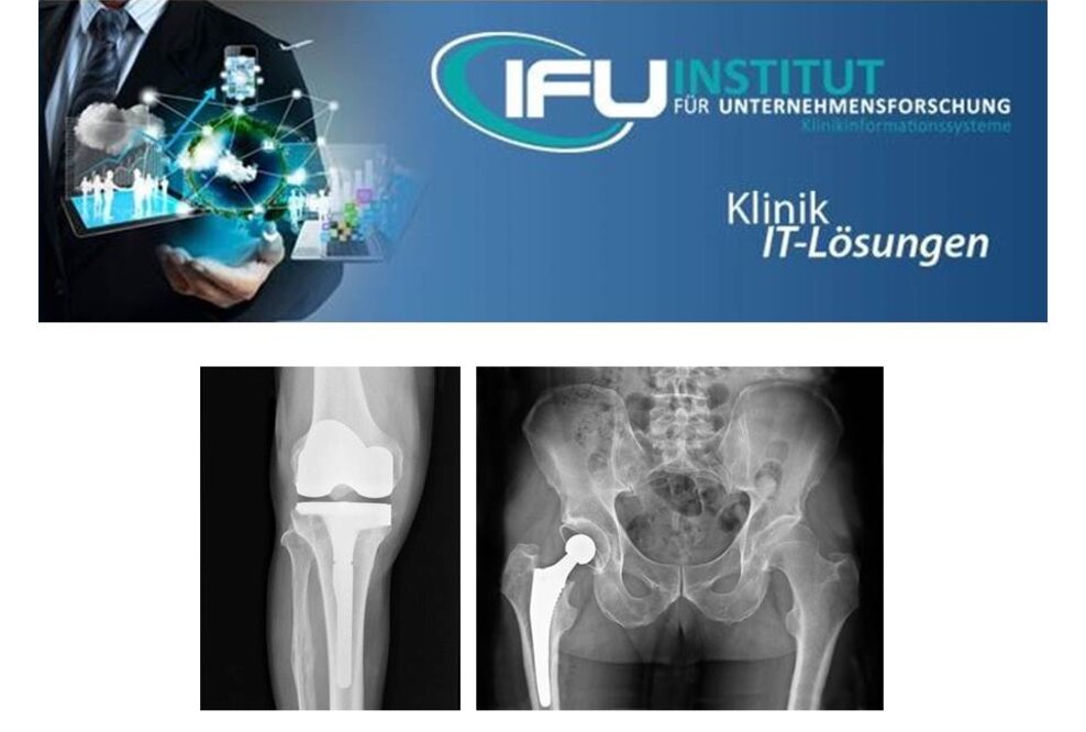 IFU Software-Erweiterung EndoProthetikZentrum