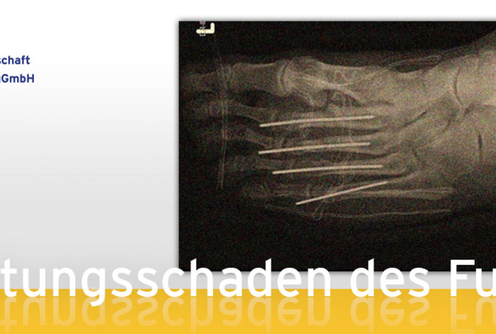 Überlastungsschaden des Fußes - Laienverständlicher Vortrag im St. Martinus-Hospital Olpe