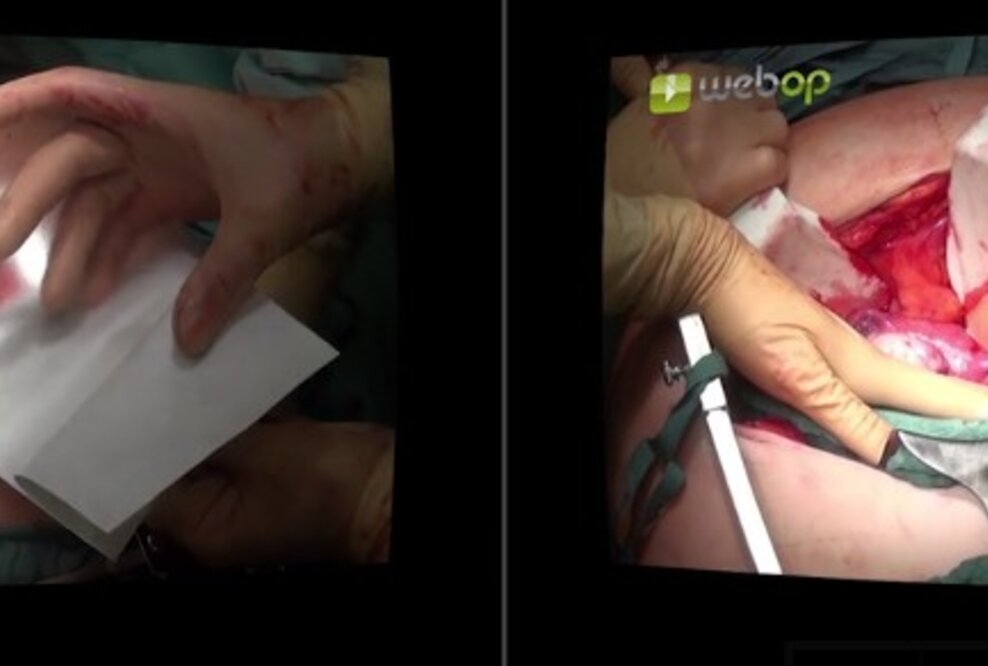 Virtual Reality (VR) – Revolution in der chirurgischen Ausbildung mit webOP