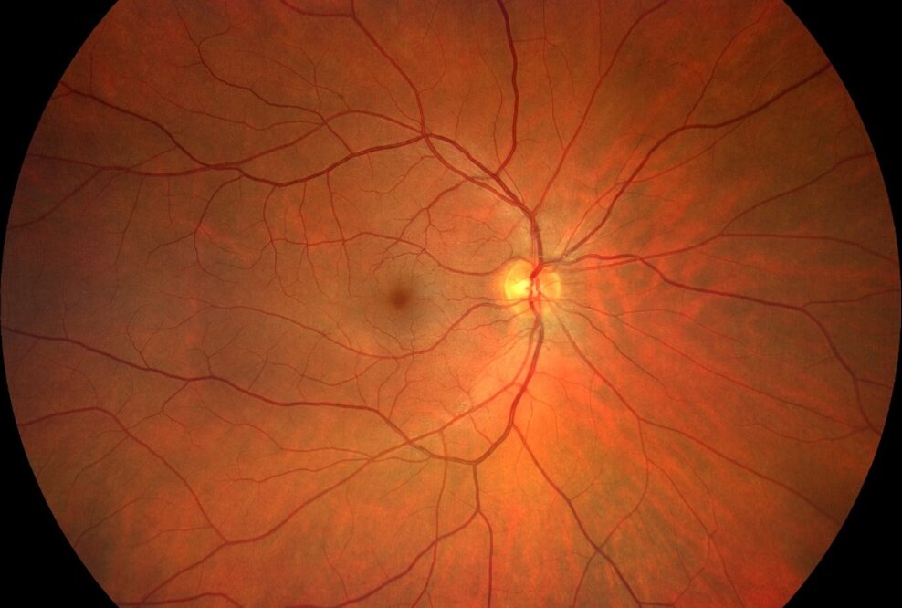 Kooperation zwischen Imedos und TU Ilmenau: Projekt InGeS optimiert Verfahren zur Früherkennung von Herz-Kreislauf-Erkrankungen