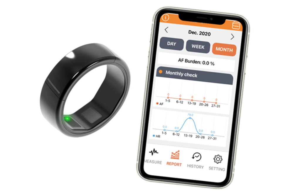EKG-Ring CART-I von Skylabs – Mobiler EKG-Ring für Kardiologen und Herzpatienten – Medizinprodukt jetzt in Deutschland erhältlich