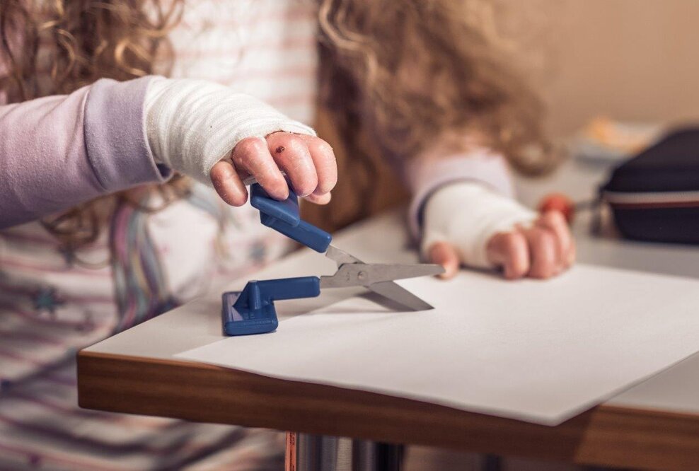 Kinder mit Epidermolysis bullosa sind wie andere Kinder, wollen spielen, basteln, lernen, Quatsch machen, sich das Leben erobern. Bei Ergotherapeut:innen lernen sie, das Verletzungsrisiko durch eine aktive Motorik, Sturzprophylaxe und Wahrnehmungstraining zu minimieren. 