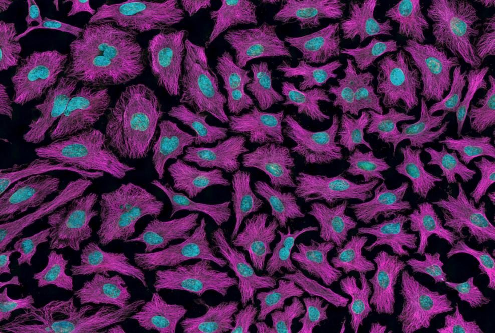 MIG Fonds erhalten erhebliche Meilensteinzahlungen aus dem Verkauf von Ganymed