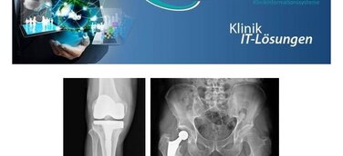 IFU Software-Erweiterung EndoProthetikZentrum