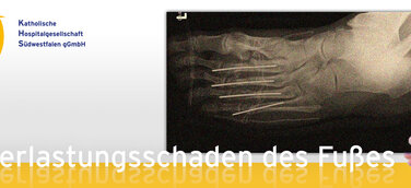 Überlastungsschaden des Fußes - Laienverständlicher Vortrag im St. Martinus-Hospital Olpe