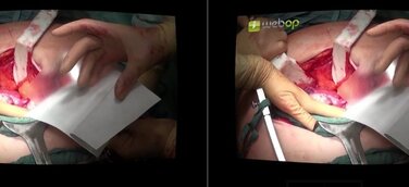 Virtual Reality (VR) – Revolution in der chirurgischen Ausbildung mit webOP