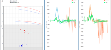 Neue Methode zur Erkennung vestibulärer Restfunktion - SHIMP