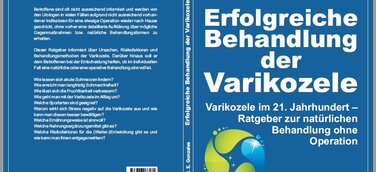 Varikozele: Welche Möglichkeiten haben die Betroffenen?