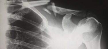 Anwälte Ciper & Coll. wieder erfolgreich vor dem Landgericht Stuttgart