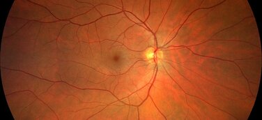 Kooperation zwischen Imedos und TU Ilmenau: Projekt InGeS optimiert Verfahren zur Früherkennung von Herz-Kreislauf-Erkrankungen