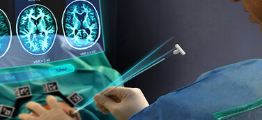 UID gewinnt mit Augmented-Reality-App für Gehirnchirurgen einen UX Design Award 2020
