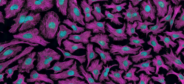 MIG Fonds erhalten erhebliche Meilensteinzahlungen aus dem Verkauf von Ganymed