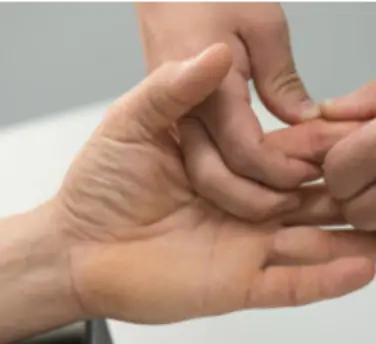 Ein Teil der ergotherapeutischen Behandlung bei Rhizarthrose ist die manuelle und funktionelle Therapie