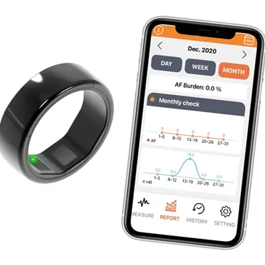 EKG-Ring CART-I von Skylabs – Mobiler EKG-Ring für Kardiologen und Herzpatienten – Medizinprodukt jetzt in Deutschland erhältlich
