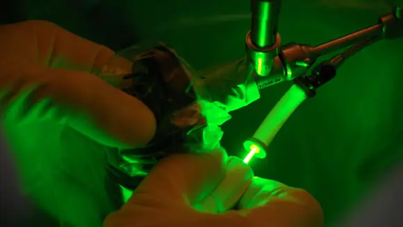 Erfolg von Greenlightlaser und Evolve-Laser nachgewiesen