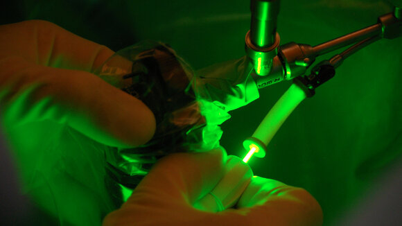 Erfolg von Greenlightlaser und Evolve-Laser nachgewiesen