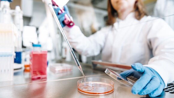 ASC Oncology beantwortet dank Testverfahren die zentrale Frage nach der Wirksamkeit von Krebsmedikamenten am Patiententumor