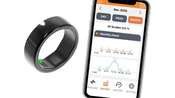 EKG-Ring CART-I von Skylabs – Mobiler EKG-Ring für Kardiologen und Herzpatienten – Medizinprodukt jetzt in Deutschland erhältlich