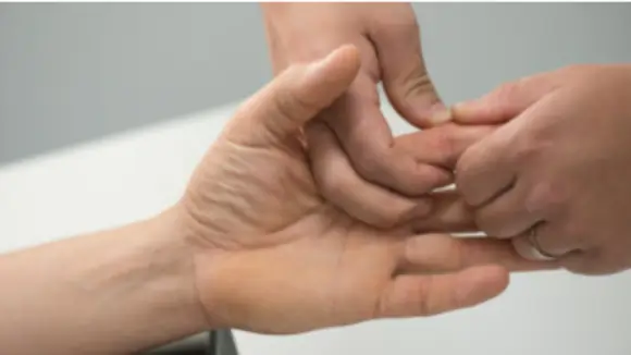 Ein Teil der ergotherapeutischen Behandlung bei Rhizarthrose ist die manuelle und funktionelle Therapie